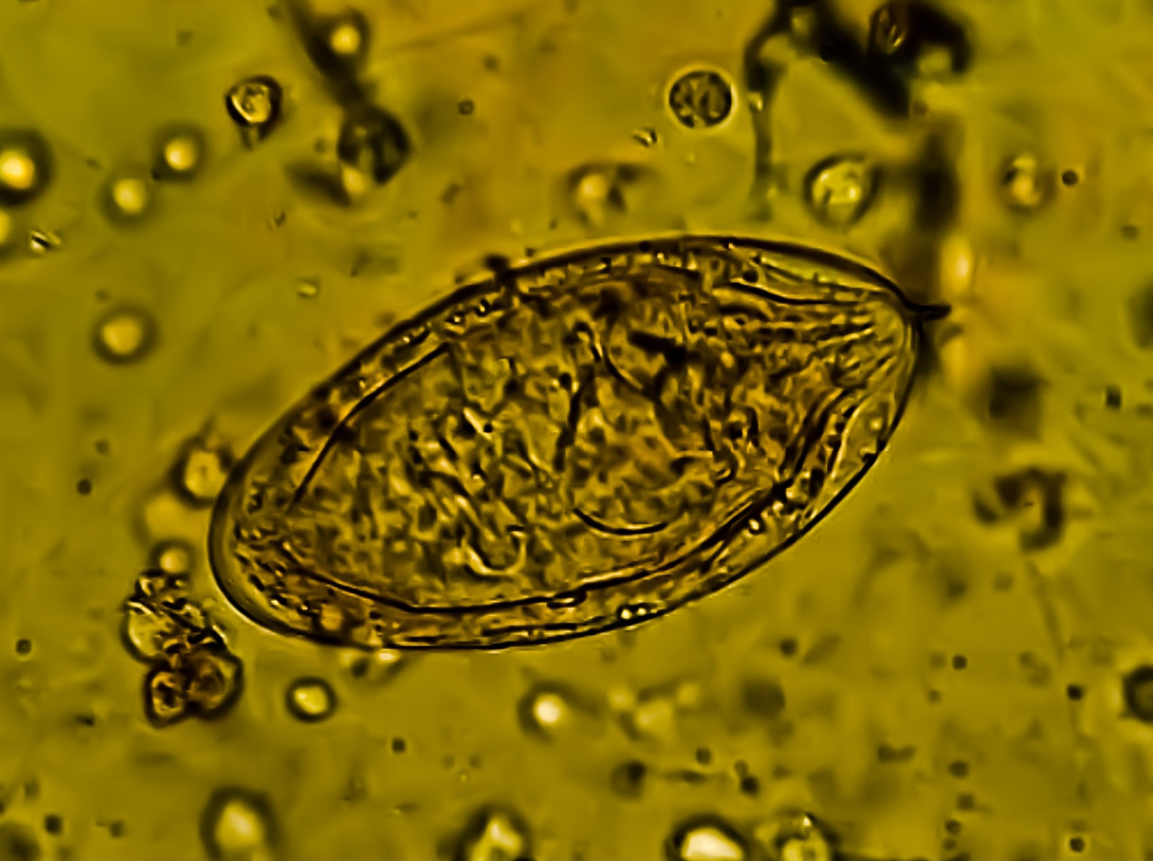 Bilharzia egg